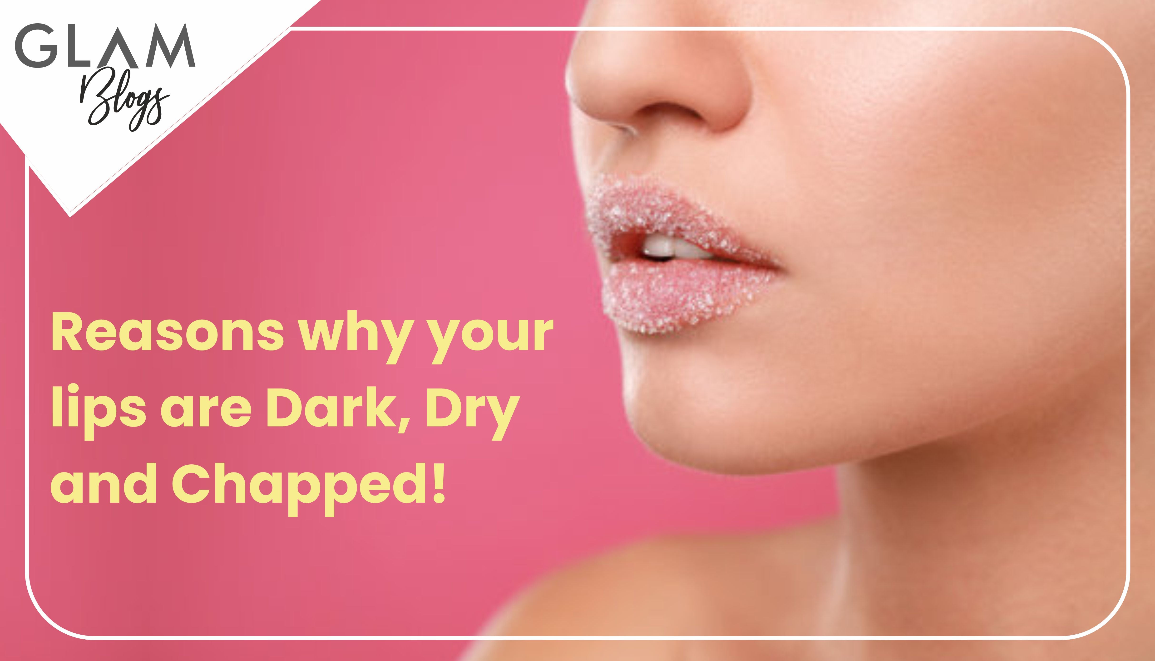 Reasons why your lips are Dark, Dry, and Chapped!