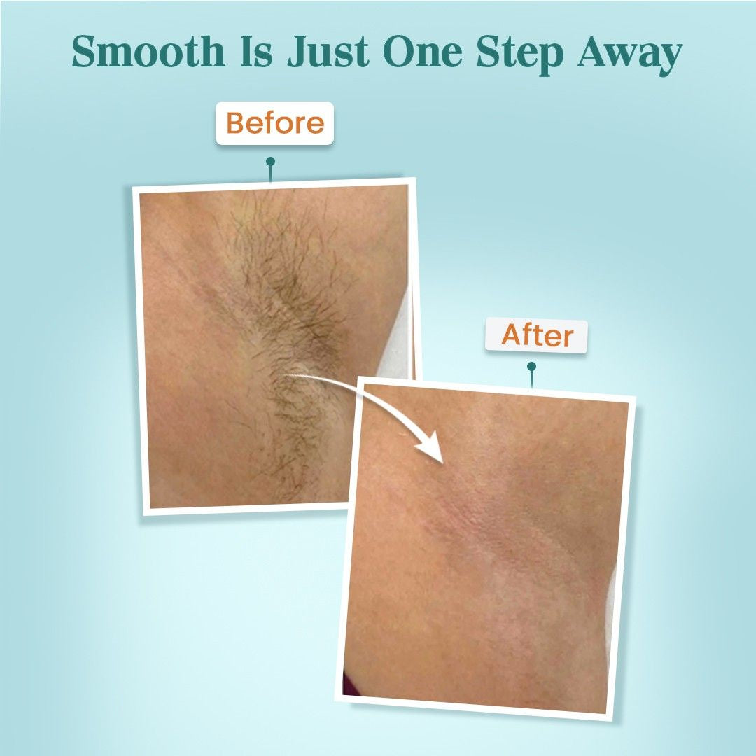 Hair Removal Cream for Women & Men 60gm