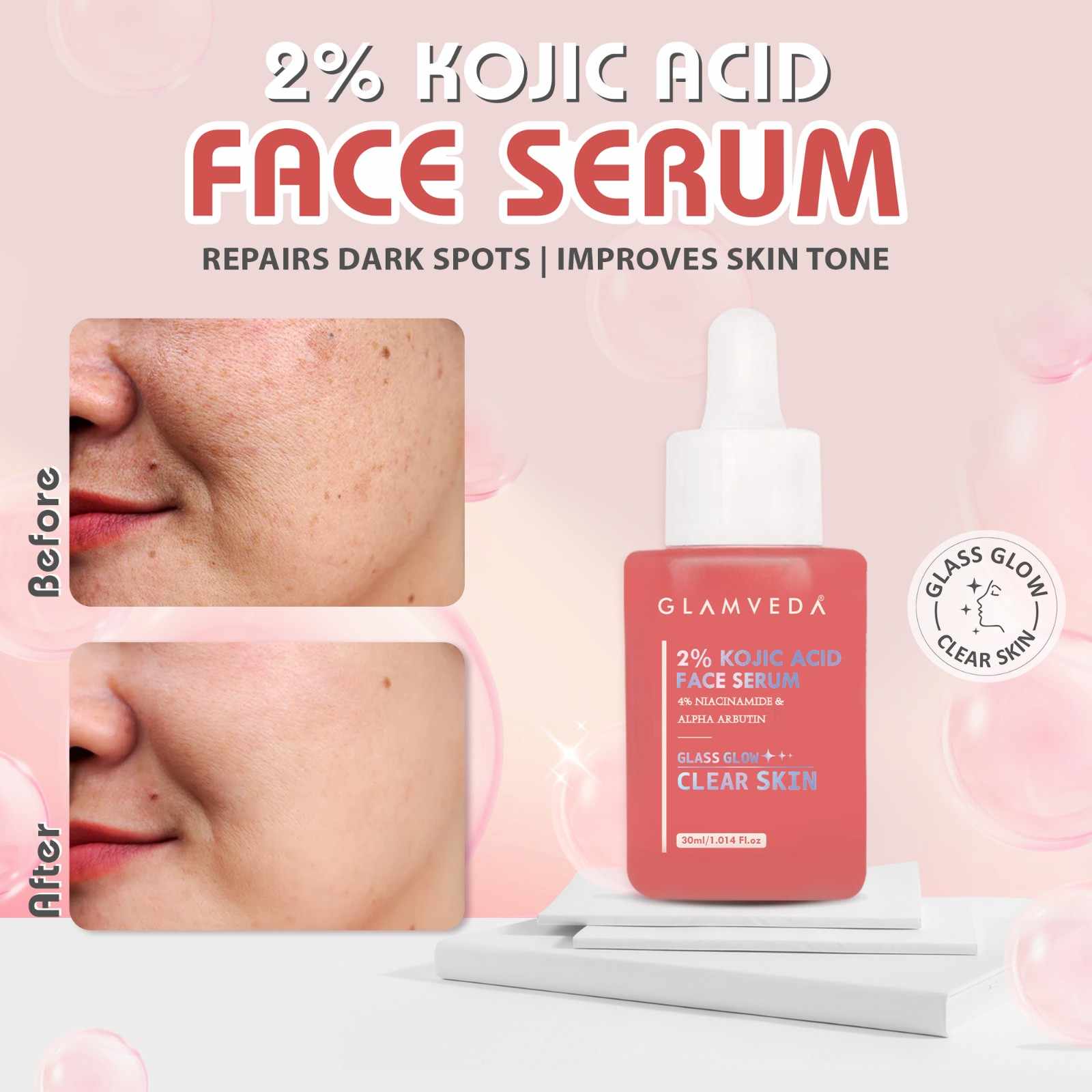 Glamveda 2% Kojic Acid Face Serum with Niacinamide & Alpha Arbutin | For Dark Spots