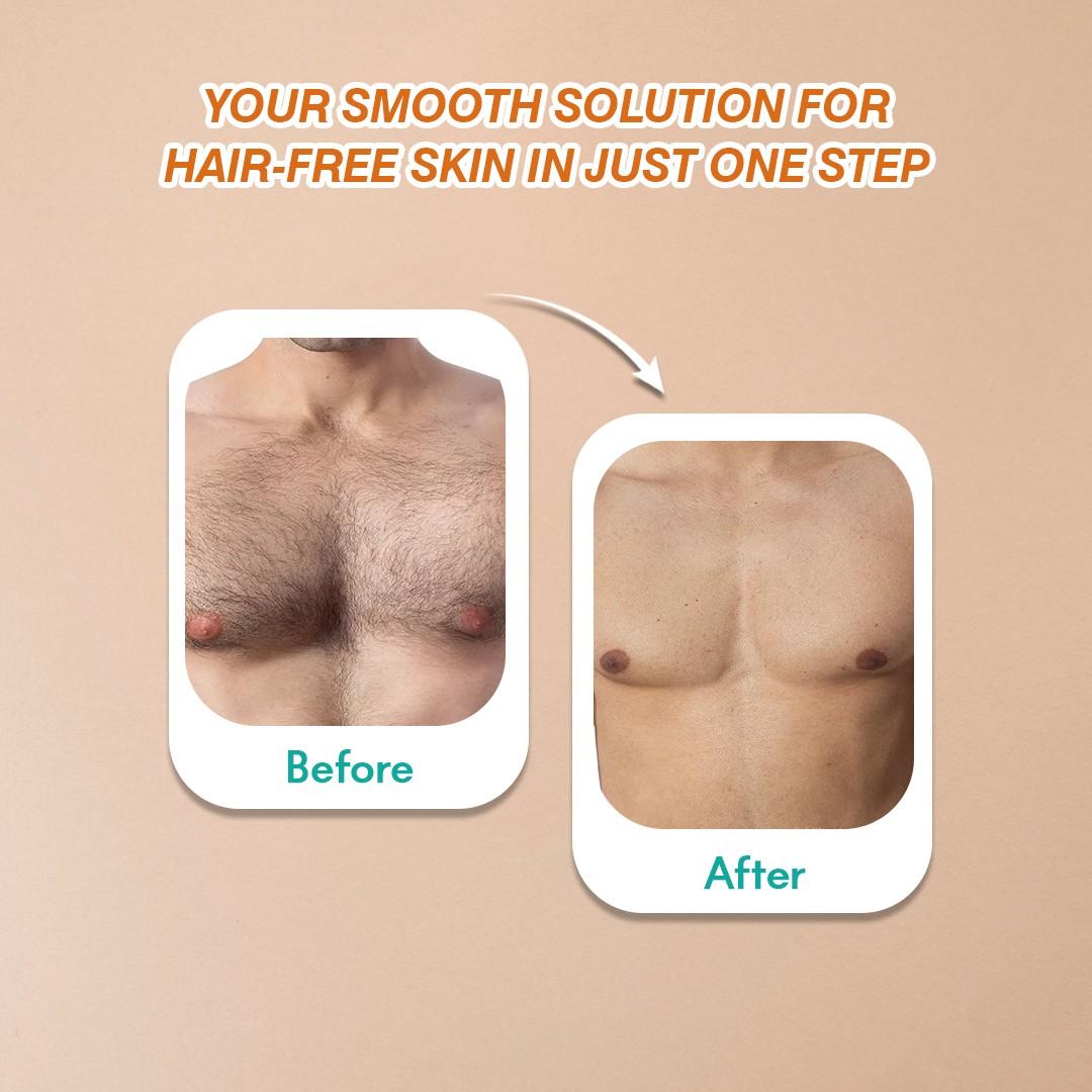 Hair Removal Combo| Spray 200ml + Free Intimate Cream 60g