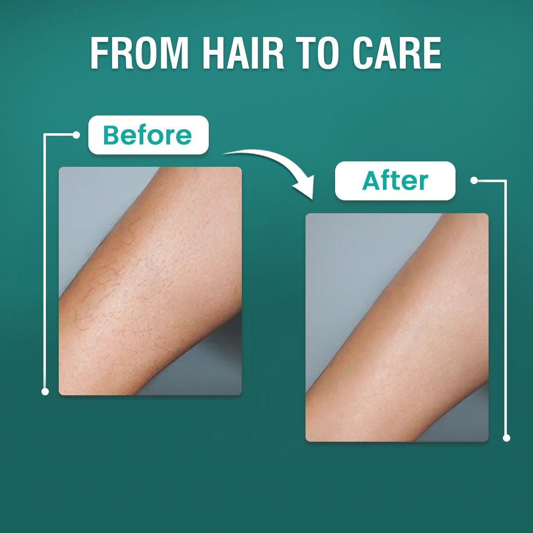 Hair Removal Cream for Women & Men 120gm