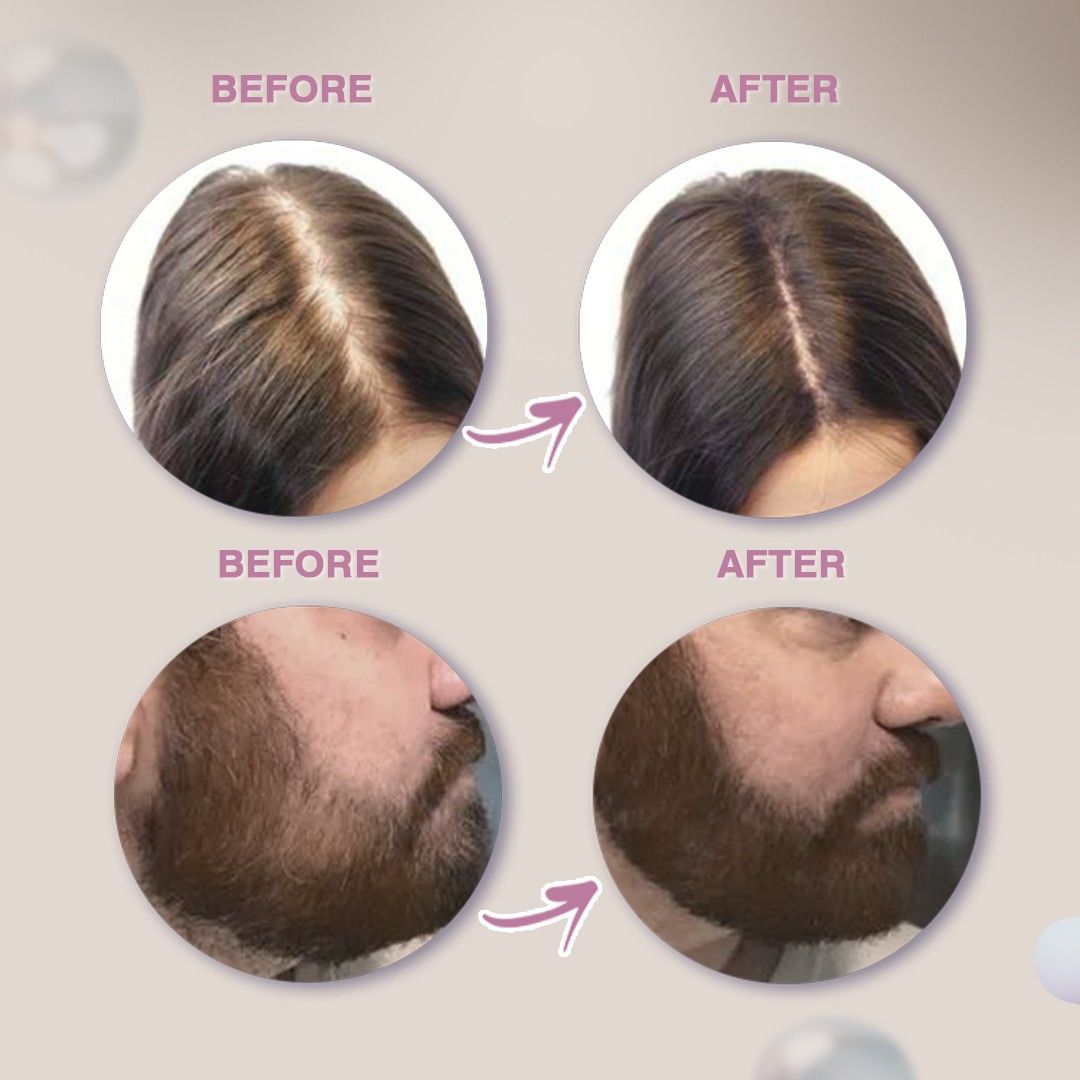 Glamveda Hair Cover-Up Powder Brown | Pack of 3 12gm