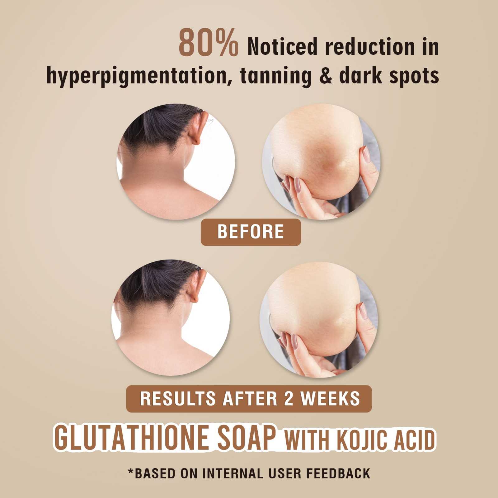Glamveda Glutathione Skin Lightening & Whitening Soap with Kojic Acid