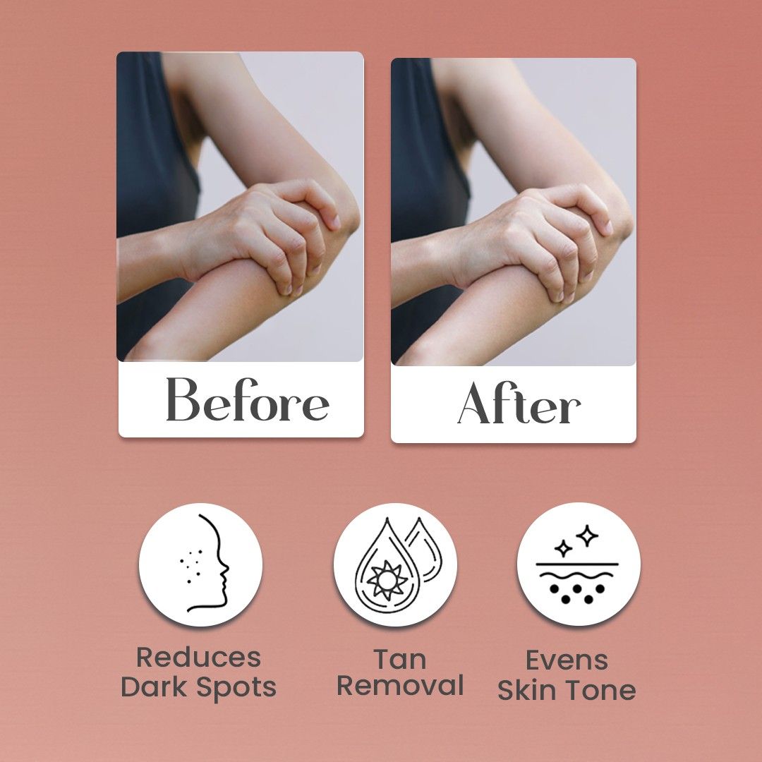 Body Lotion with Kojic Acid & Alpha Arbutin | Moisturizer | Deeply Nourishes & protects Skin