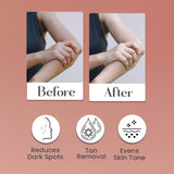 Body Lotion with Kojic Acid & Alpha Arbutin | Moisturizer | Deeply Nourishes & protects Skin