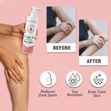 Body Lotion with Kojic Acid & Alpha Arbutin | Moisturizer | Deeply Nourishes & protects Skin