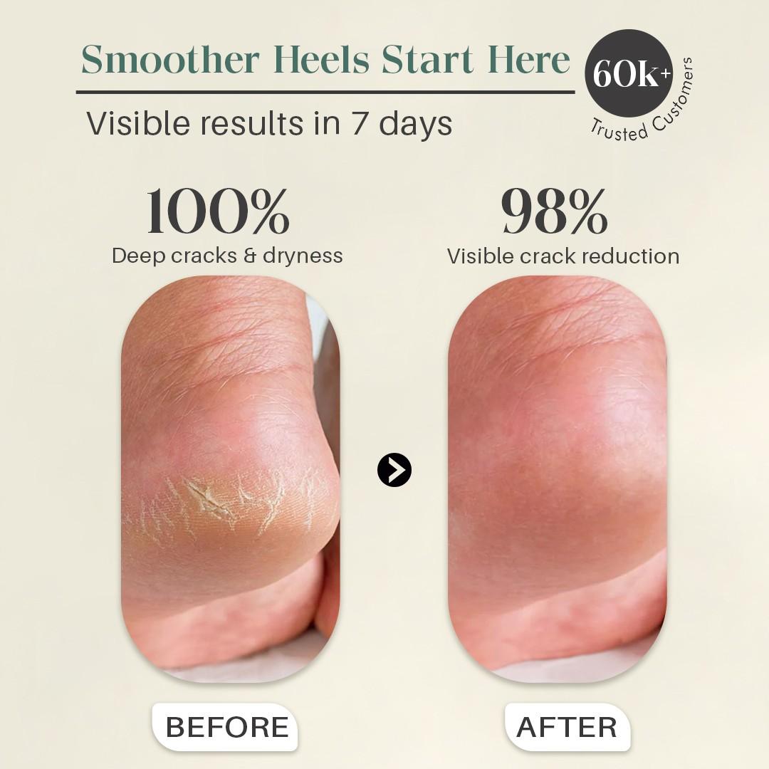 Glamveda Happy Foot Care Cream for Cracked Heels | Nourishment & Hydration