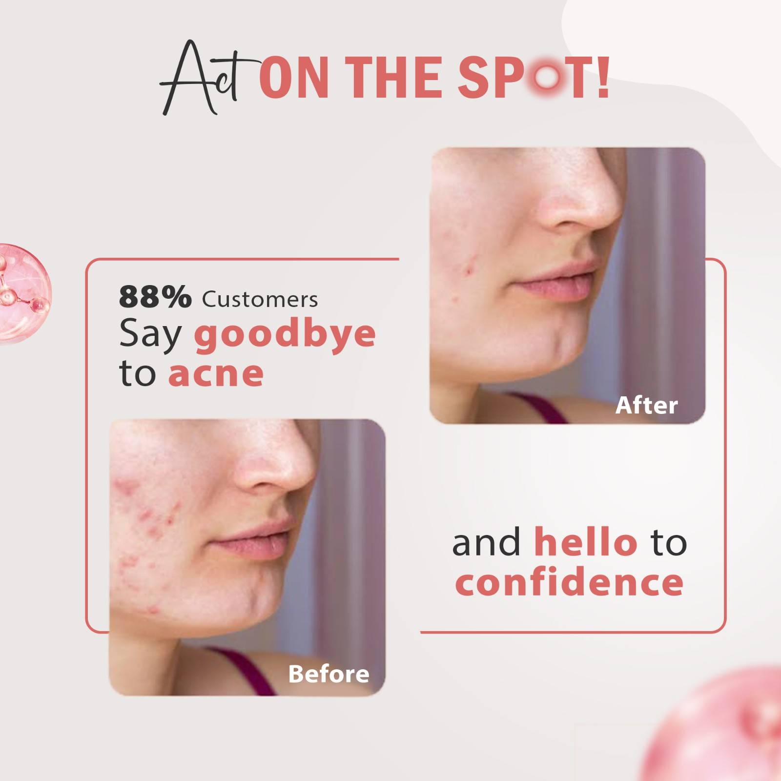 Glamveda 3% Kojic Acid Spot Corrector Gel Reduces Acne Scars & Dark Spots | Glow Booster & Pigmentation Removal