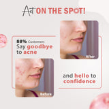 Glamveda 3% Kojic Acid Spot Corrector Gel Reduces Acne Scars & Dark Spots | Glow Booster & Pigmentation Removal